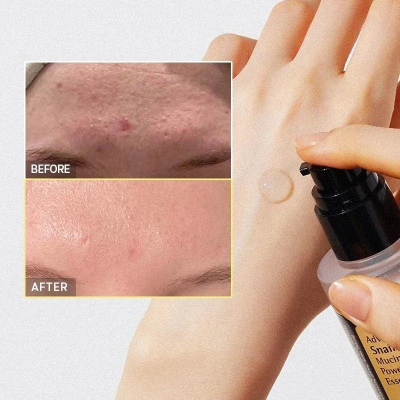 Snail Collagen Face Cream – Repairing & Firming Korean Skincare